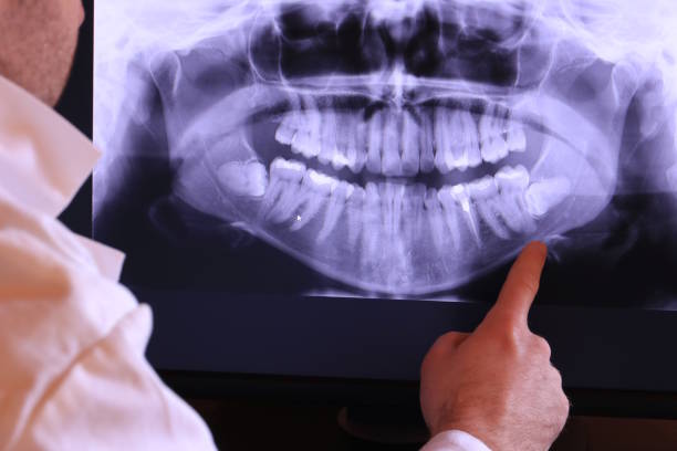 Best Emergency Dental Services for Seniors in Cornish, ME