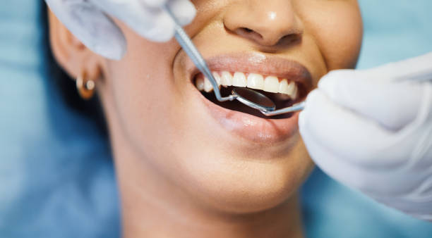 Best Emergency Dentist for Knocked-Out Tooth in Cornish, ME