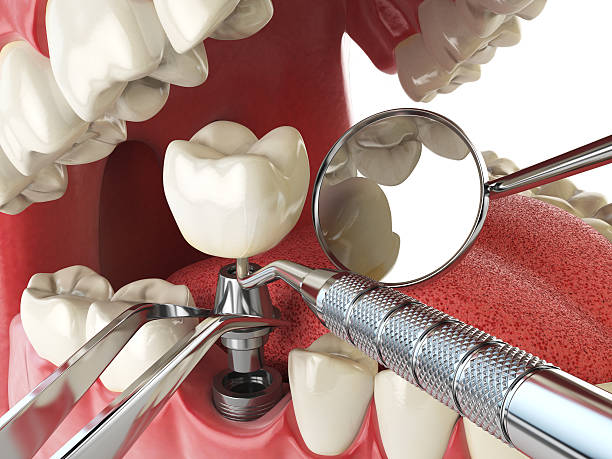 Trusted ME Emergency Dentist Experts