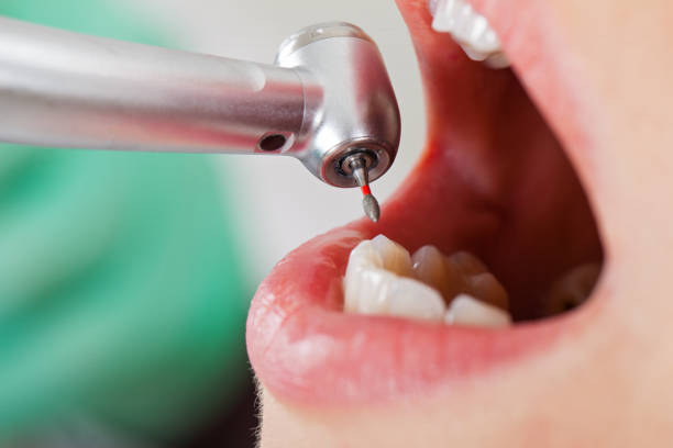 Best Emergency Cosmetic Dentistry in Cornish, ME